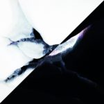 Patrick F. Patrick - Deine Augen, meine Tränen (Vinyl)